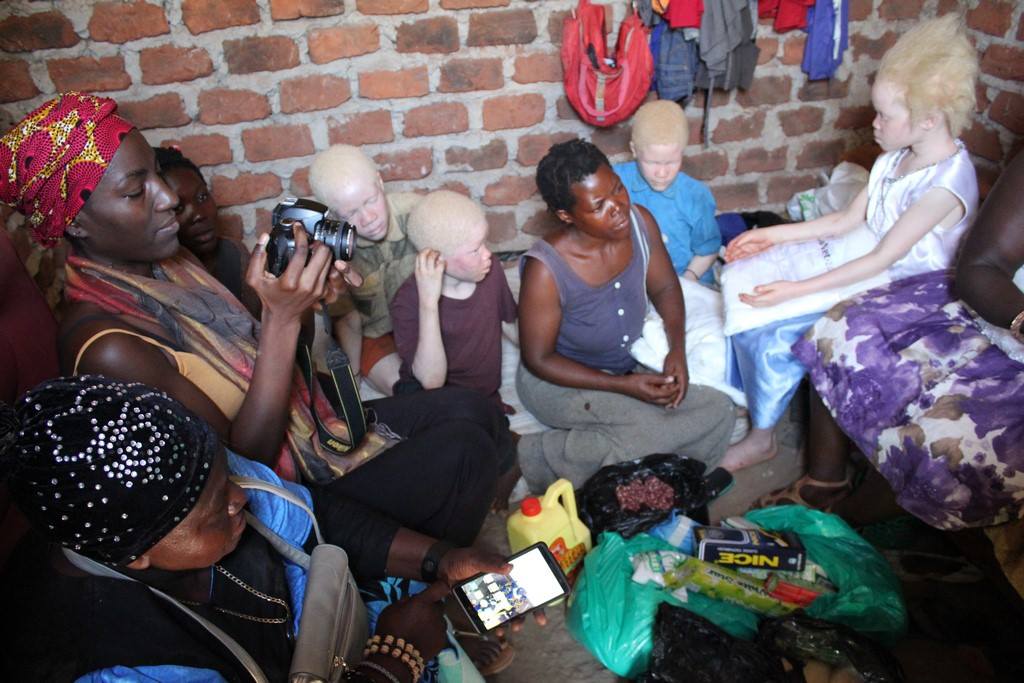 Albinism Crisis Outreach Fredah